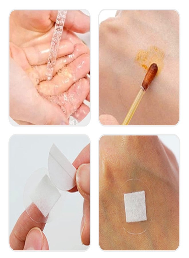 AndicAge 100pcs Adhesive Spot Bandage 1 Inch Clear Round Adhesive Bandages with Non-Stick Pad for Hands, Arms Small Wounds, 1 Box - Image 5